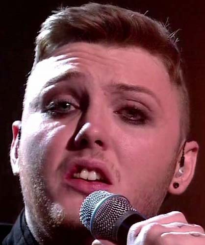 X Factor winner James Arthur is looking forward to getting his teeth fixed, admitting that he's always been self conscious about them - particularly after comedian Frankie Boyle described him as looking 